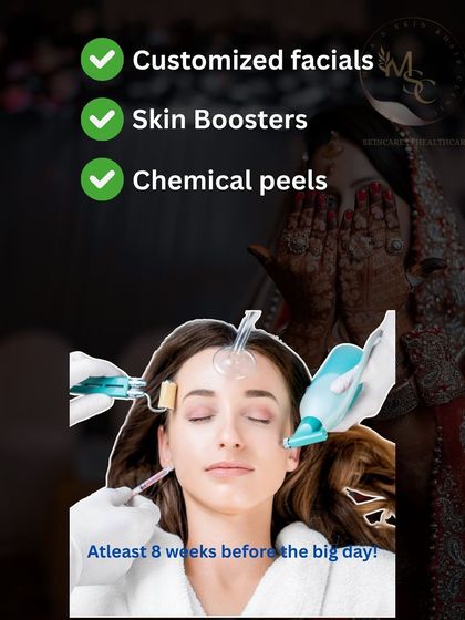 Pre-Bridal Glow-Up Plans photo 6