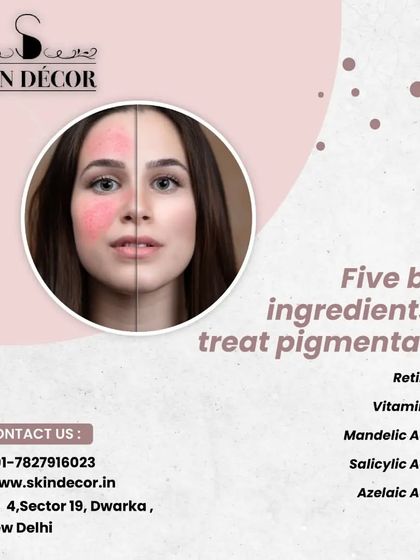 Dealing with pigmentation? There are five key ingredients I often recommend to my patients. These include Retinol, Vitamin C, Mandelic Acid, Salicylic Acid, and Azelaic Acid, each working in different ways to improve skin tone.