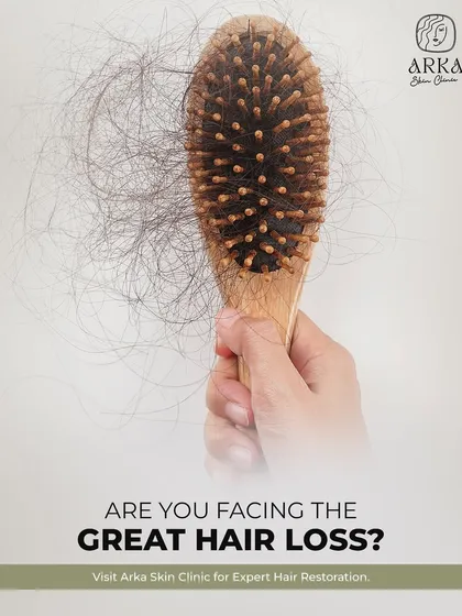 Seeing a lot of hair on your brush can be alarming. If you are facing the great hair loss, it is time to visit us for expert hair restoration solutions.