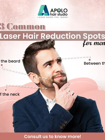 Laser hair reduction is not just for women. We provide precise grooming solutions for men who want to maintain a sharp, clean look. This includes defining beard lines, cleaning up the nape of the neck, and removing unwanted hair between the eyebrows for a polished appearance.
