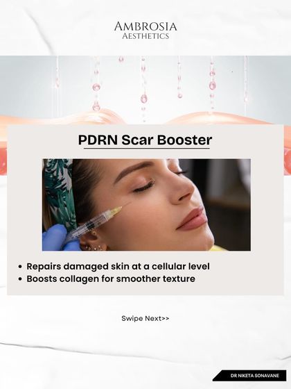 PDRN Scar Booster is a powerful tool for repairing damaged skin. It works at a cellular level to boost collagen, which is essential for smoothing the texture of acne scars and improving overall skin health.