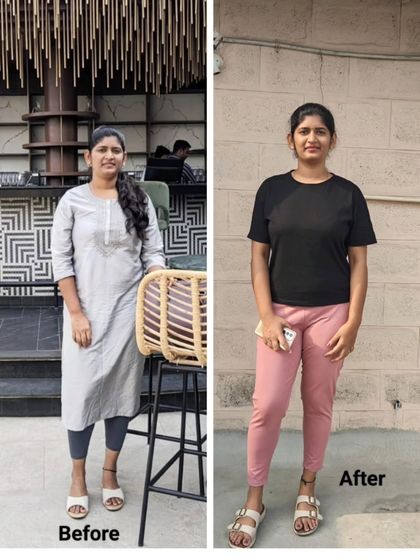 In this before and after, you can see a 5 kg weight loss, but also notice the body toning, reduction in face fat and double chin, and overall posture correction.