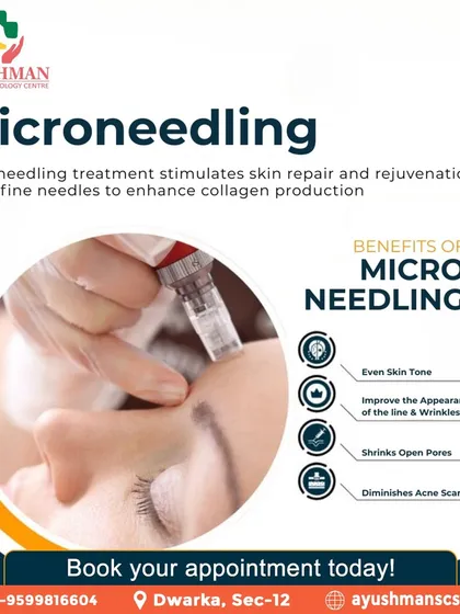 Microneedling is a powerful tool for skin regeneration. This infographic explains how the treatment stimulates collagen to improve skin tone, reduce the appearance of wrinkles, and diminish acne scars.