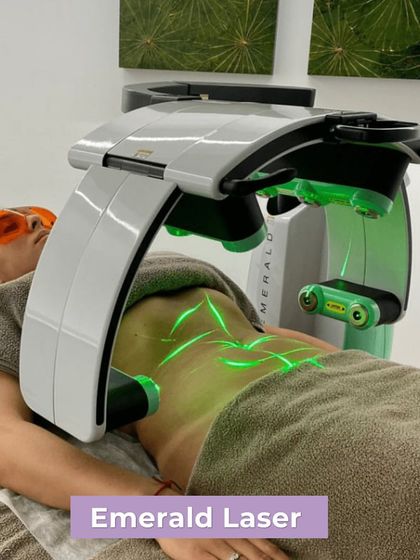 A client undergoes a session with the Emerald Laser, a key part of our body contouring services. This treatment is perfect for overall inch loss and is a popular choice for those preparing for a big event like a wedding.
