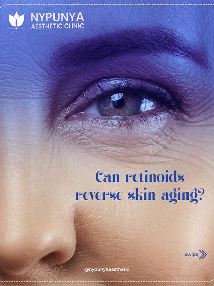 Can retinoids reverse skin aging? This is a question I get asked frequently in my clinic.