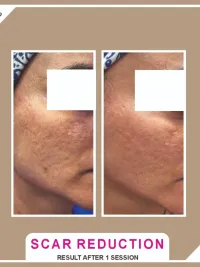 Advanced Facials & Skin Treatments