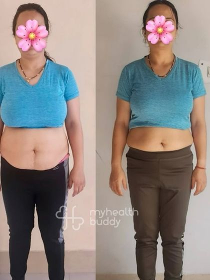 This postpartum mom lost 9 kgs in 6 months. Her journey shows that even with the challenges of a new baby, consistent effort in both nutrition and exercise leads to amazing, sustainable results.