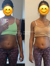 Postpartum Fitness & Recovery