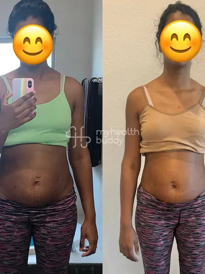 This client wanted to get rid of her postpartum weight and get fitter. She lost 5 kgs in the first month and went on to tone her body and improve her PCOD symptoms with a plan that fit her busy schedule.