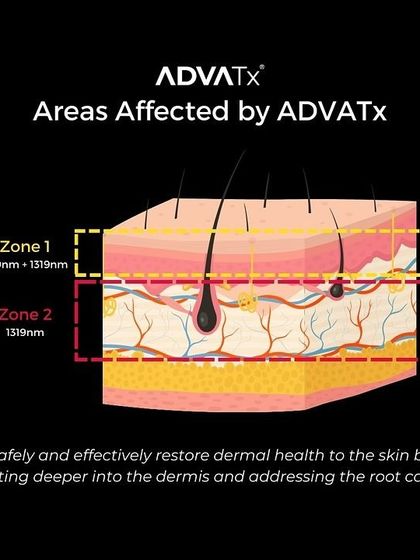 A diagram showing how AdvaTx works. The 589nm wavelength targets superficial vascular and pigment issues, while the 1319nm wavelength penetrates deeper to remodel collagen and address concerns like acne and wrinkles at their source.