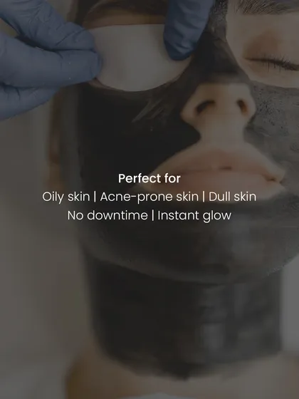 This image shows the final steps of a Carbon Facial, where eye protection is used during the laser portion. The treatment is perfect for oily, acne-prone, or dull skin and delivers an instant glow with no recovery time.