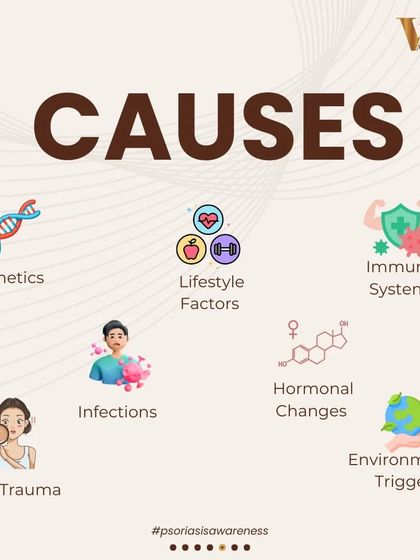 The causes of psoriasis are complex and multi-faceted. This graphic shows the various factors that can contribute, including genetics, lifestyle, immune system responses, infections, hormonal changes, and environmental triggers.