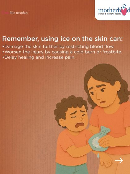It's a common instinct to reach for ice, but you should never use it on a burn. Ice can restrict blood flow and cause a cold burn or frostbite, which worsens the injury and delays healing. Cool running water is always the best first response.