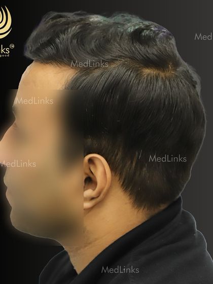 A different angle of the final result, highlighting the excellent density.