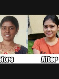 Natural Skin Brightening Treatments