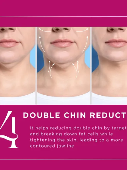 HIFU is an excellent tool for double chin reduction. The focused ultrasound energy targets and breaks down fat cells while also tightening the surrounding skin, leading to a more defined and contoured jawline.