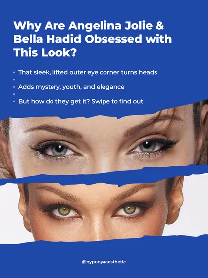 The sleek, lifted outer eye corner seen on celebrities like Angelina Jolie and Bella Hadid adds an element of youth and elegance. There are specific procedures to achieve this look.