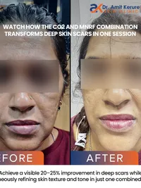 Anti-Aging & Skin Rejuvenation