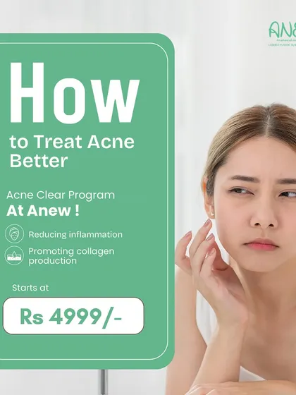 Our Acne Clear Program is a customized plan that starts at just ₹4999. We focus on reducing inflammation and promoting collagen production, tailoring the treatment to your specific skin needs and lifestyle for clear, healthy skin.