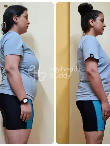 The side profile of Shipra's transformation clearly shows the significant fat loss and improved body composition she achieved. This is the result of focusing on sustainable habits.