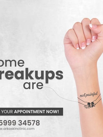 Some breakups don't have to be painful. Our laser tattoo removal process is designed to be as comfortable as possible.