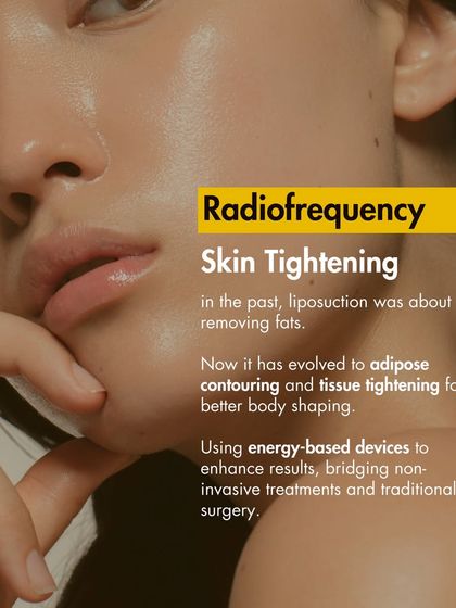 Radiofrequency (RF) skin tightening is a fantastic non-invasive treatment. It uses energy to heat the deeper layers of skin, stimulating collagen and elastin production for a firmer, more youthful appearance with zero downtime.