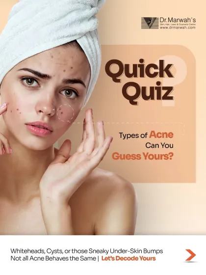 Understanding your acne is the first step towards effectively treating it. This quiz is designed to help you identify your acne type, from whiteheads to deeper cysts, so you can understand the targeted, science-backed treatments we offer for each specific concern.