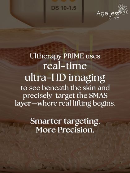 Precision is the key to an effective lift. Ultherapy PRIME uses real-time ultra-HD imaging, allowing me to see beneath the skin and precisely target the SMAS layer where true lifting begins. This ensures every pulse of energy is delivered exactly where it's needed most.