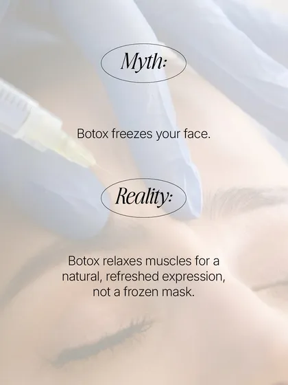 One of the most common myths is that Botox freezes your face. The reality is, when administered by an expert dermatologist, it selectively relaxes muscles to smooth wrinkles while preserving your natural expressions for a refreshed, not frozen, look.