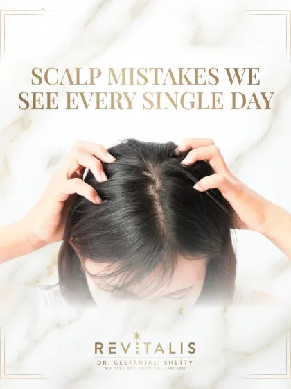 Most hair problems don't start with your hair, they start at the scalp. I see patients making the same scalp care mistakes every day, which often leads to issues like hair fall, dandruff, and dullness. The first step to healthy hair is always a proper diagnosis of your scalp.