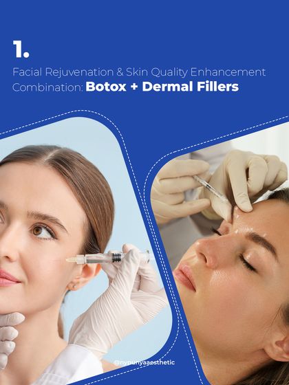 For comprehensive facial rejuvenation, I often combine Botox and dermal fillers. Botox addresses the dynamic wrinkles caused by muscle movement, while fillers restore volume and structure. Together, they provide a harmonious and balanced anti-aging result.