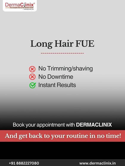 The key benefits of Long Hair FUE are simple: no trimming or shaving, no downtime, and instant results. You can get back to your routine in no time.