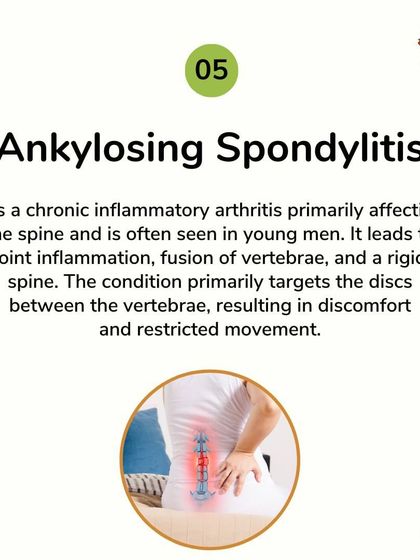 Ankylosing Spondylitis is an inflammatory arthritis affecting the spine. My therapies are designed to reduce inflammation, prevent the fusion of vertebrae, and improve the flexibility of the spine for better comfort and movement.