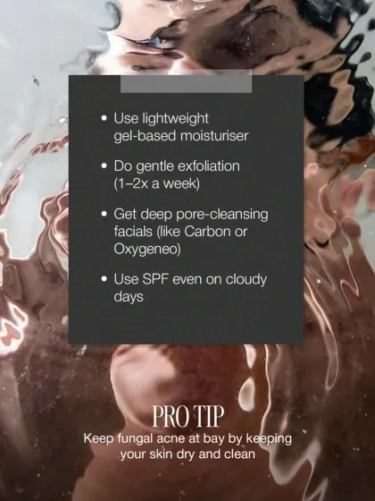 Monsoon season requires adjustments to your skincare routine. This pro-tip graphic advises using lightweight moisturizers, gentle exfoliation, deep-cleansing facials like Carbon or Oxygeneo, and consistent SPF use to prevent breakouts.