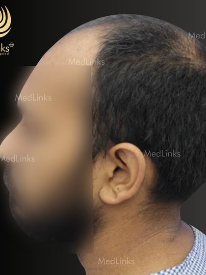 Another 'before' angle from the side.