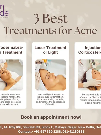 Here are three of our most effective treatments for acne: Microdermabrasion for texture, Laser or Light therapy to reduce inflammation, and Injections for severe breakouts.