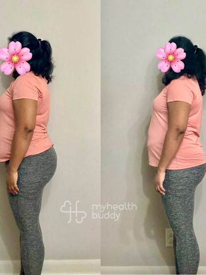 Starting at 98 kgs, this client lost 5 kgs in 3 months while living overseas with a hectic schedule. Even after twisting her ankle, we focused on ankle-strengthening exercises and she recovered stronger than before.