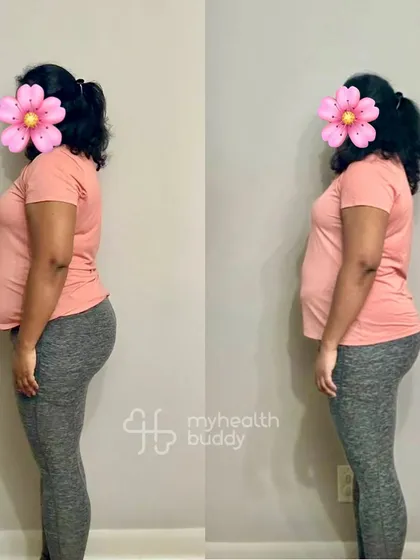 Starting at 98 kgs, this client lost 5 kgs in 3 months while living overseas with a hectic schedule. Even after twisting her ankle, we focused on ankle-strengthening exercises and she recovered stronger than before.