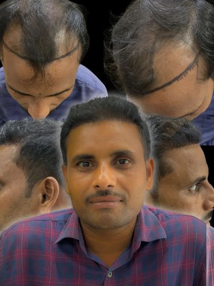 Another angle of the transformation. We ensure that the result looks great from every side, giving you a complete solution.