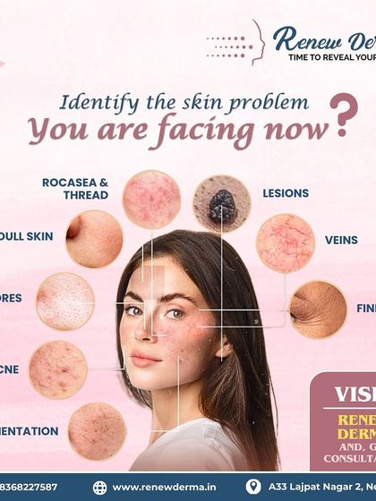 This graphic helps you identify the skin problem you might be facing, from rosacea and dull skin to pores, acne, and fine lines. Understanding your concern is the first step toward finding the right treatment plan with us.