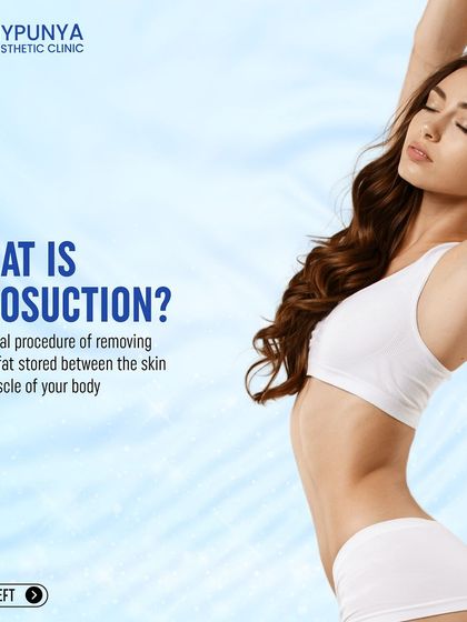 What is liposuction? It's a surgical procedure for removing the excess fat stored between the skin and muscle, allowing us to sculpt and contour your body.