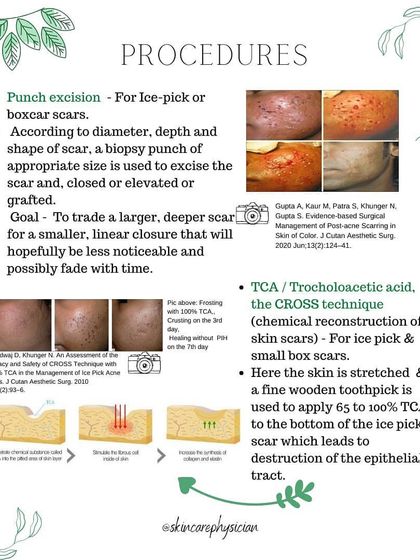 For deep ice pick and boxcar scars, I use targeted procedures like Punch Excision and TCA CROSS. These techniques are designed to precisely treat individual scars, trading a deep scar for a much less noticeable, smaller one.