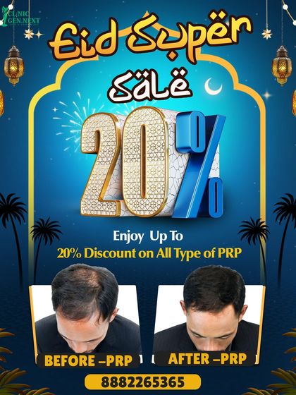 To celebrate Eid, we are offering a special discount of up to 20% on all our PRP treatments. This is a great opportunity to start your journey towards healthier, fuller hair.