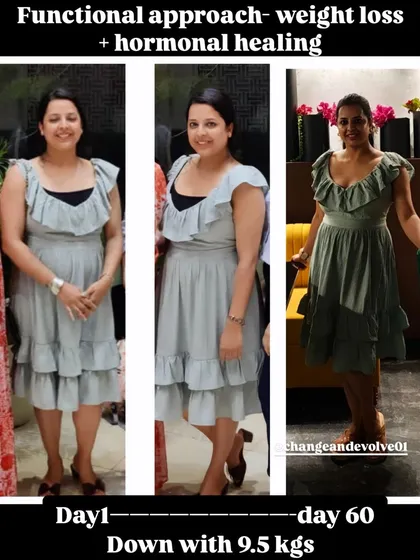 Down by 9.5 kgs in 60 days. This dermatologist client achieved this transformation through a functional approach focusing on weight loss and hormonal healing.