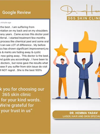 I am always grateful to hear from my clients. This review highlights a successful treatment for hypopigmentation, a condition where patches of skin become lighter than the surrounding skin. We used a combination of chemical peels and oral medication to restore pigment and achieve significant improvement.