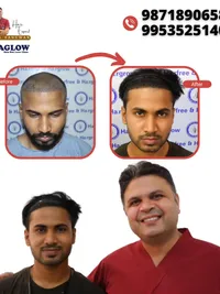 Hair Loss & Restoration