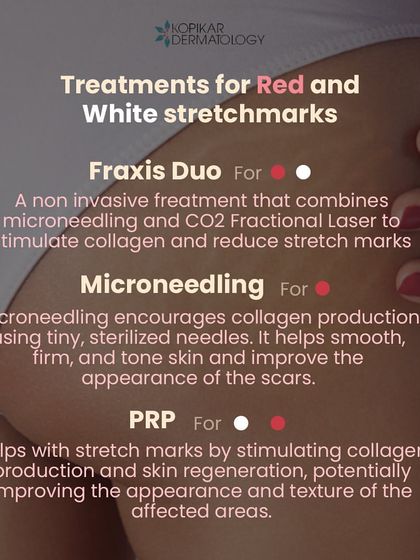 Stretch marks, both red and white, can be effectively treated with the right technology. I use a combination of treatments like Fraxis Duo, which combines micro-needling and CO2 laser, as well as PRP to stimulate collagen and improve the texture of the affected skin.