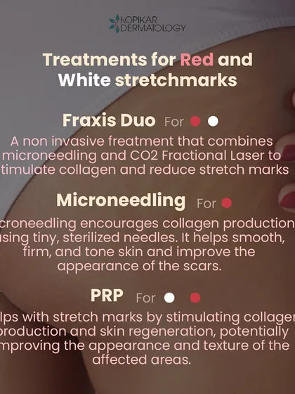 I offer multiple effective treatments for stretch marks. Fraxis Duo combines microneedling and CO2 laser, while standalone Microneedling and PRP (Platelet-Rich Plasma) therapy both work by stimulating collagen production to regenerate the skin and improve texture.