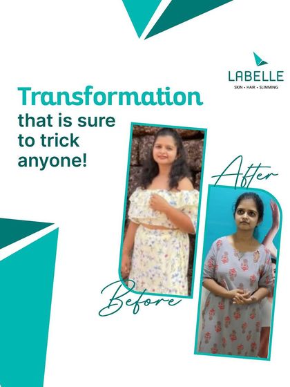 LaBelle - Body Contouring & Weight Management Real Results: Before & After photo 5