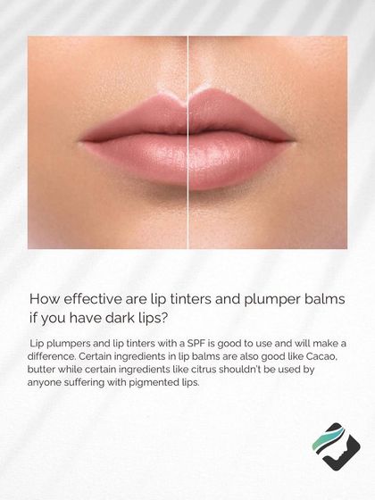 A before-and-after illustration showing the potential results of lip color correction. The goal is to achieve a more uniform and natural-looking lip shade.